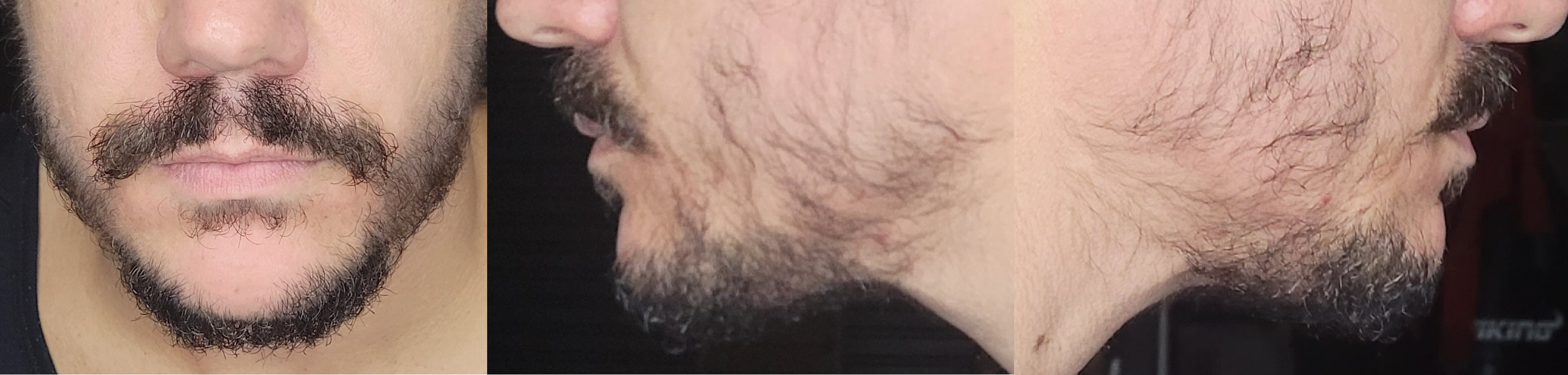 blog/growing-a-beard/2021-05-02.jpg