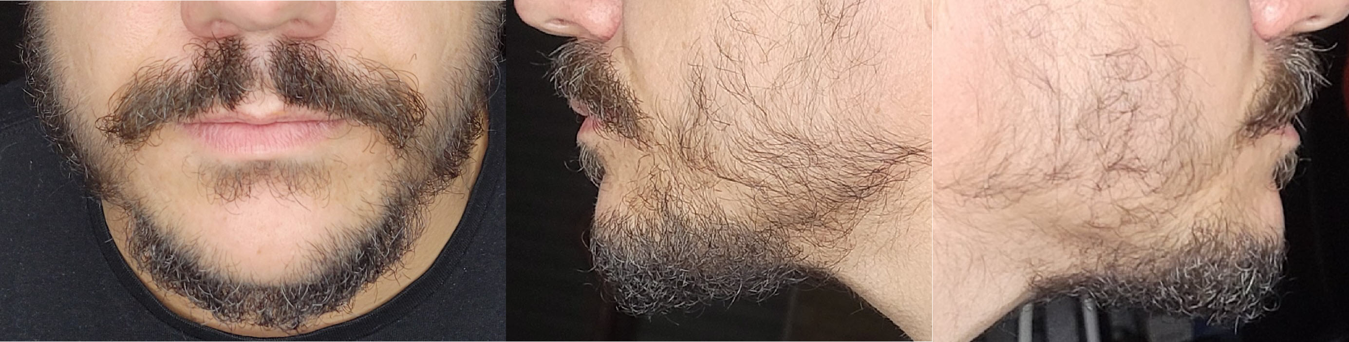 blog/growing-a-beard/2021-05-15.jpg