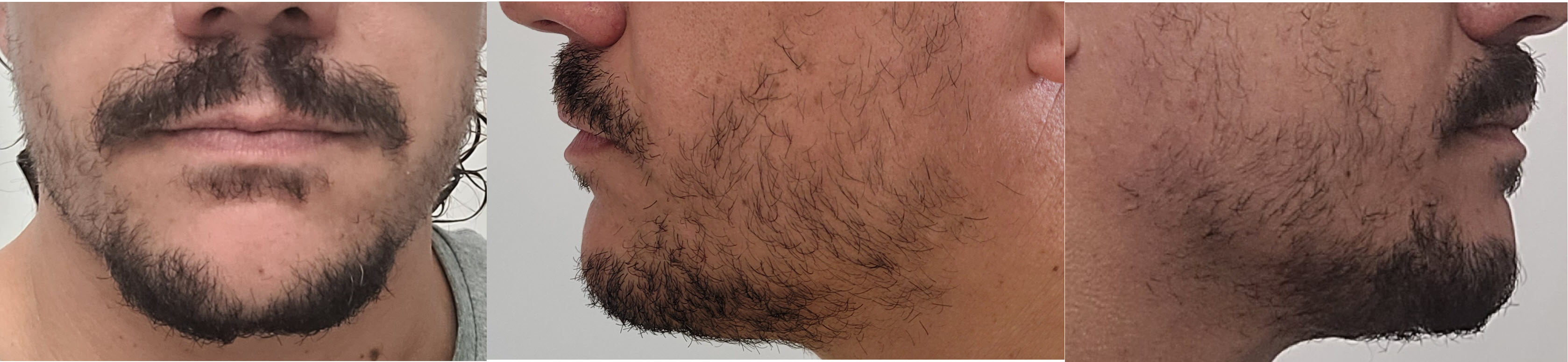 blog/growing-a-beard/2022-03-15.jpg