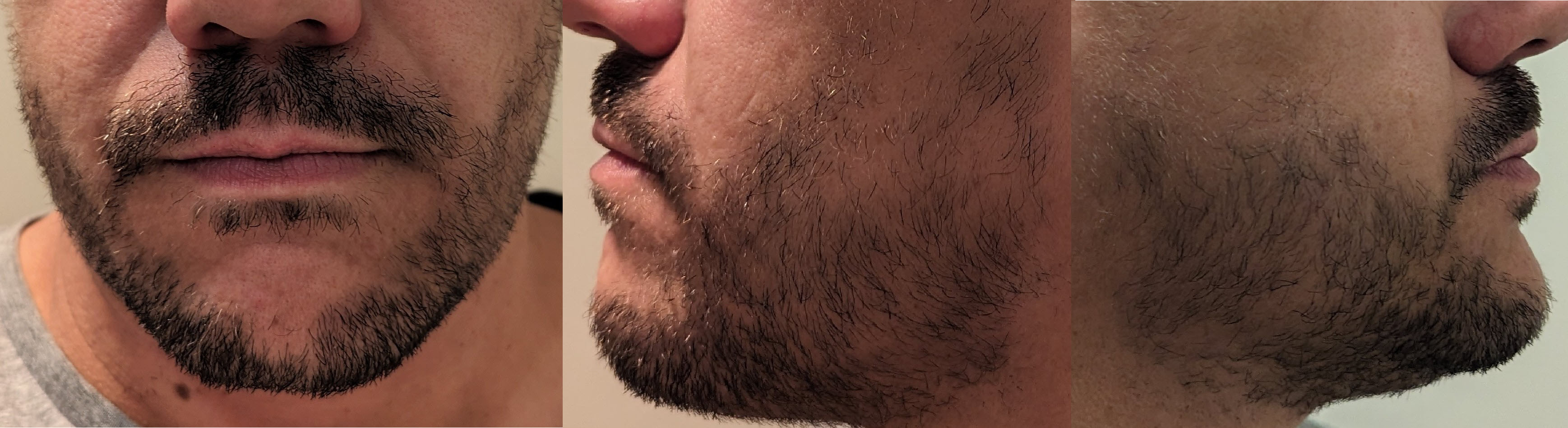 blog/growing-a-beard/2023-07-18.jpg