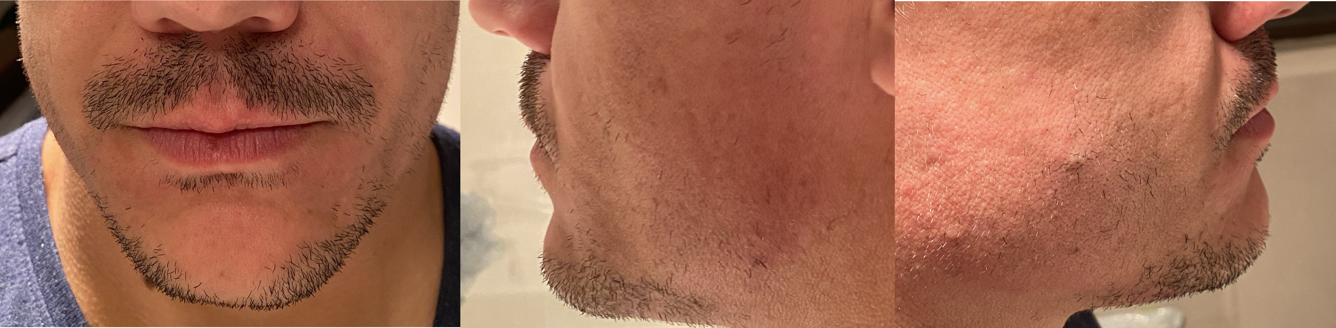 blog/growing-a-beard/2020-07-19.jpg