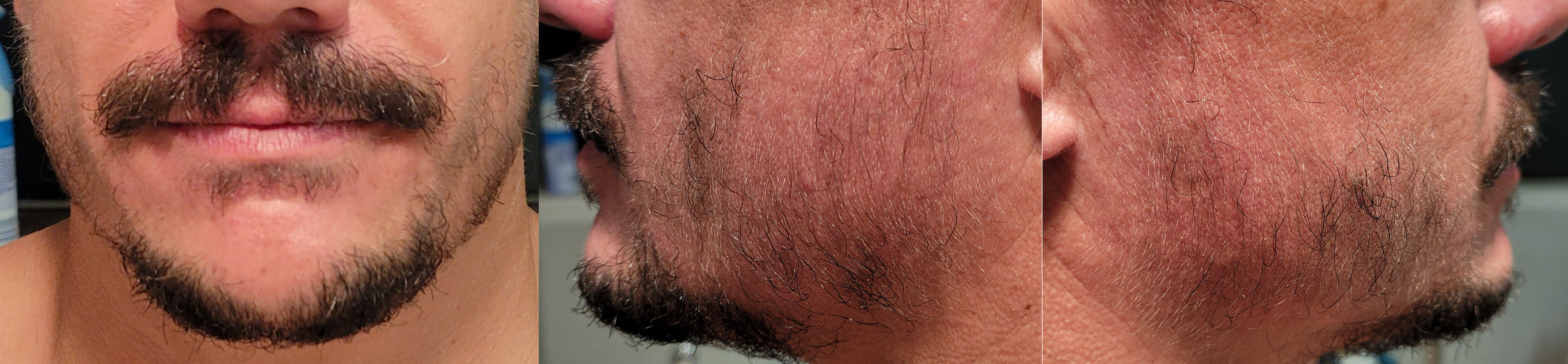 blog/growing-a-beard/2020-10-18.jpg