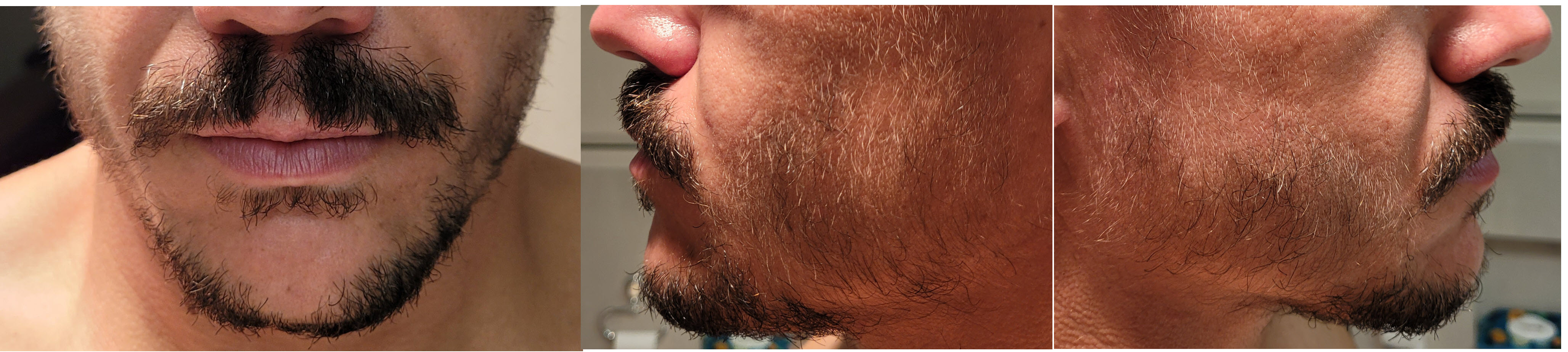 blog/growing-a-beard/2020-11-15.jpg