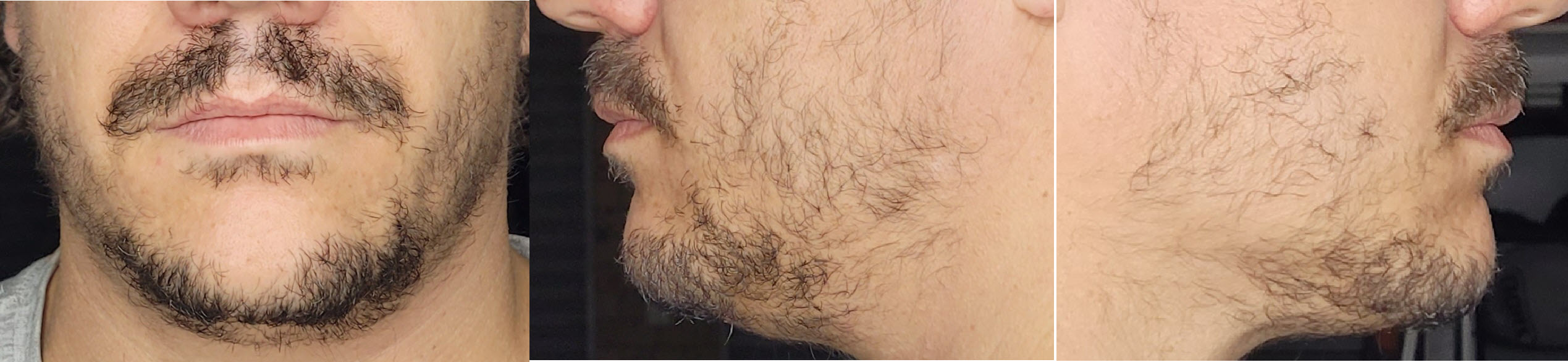 blog/growing-a-beard/2021-06-24.jpg