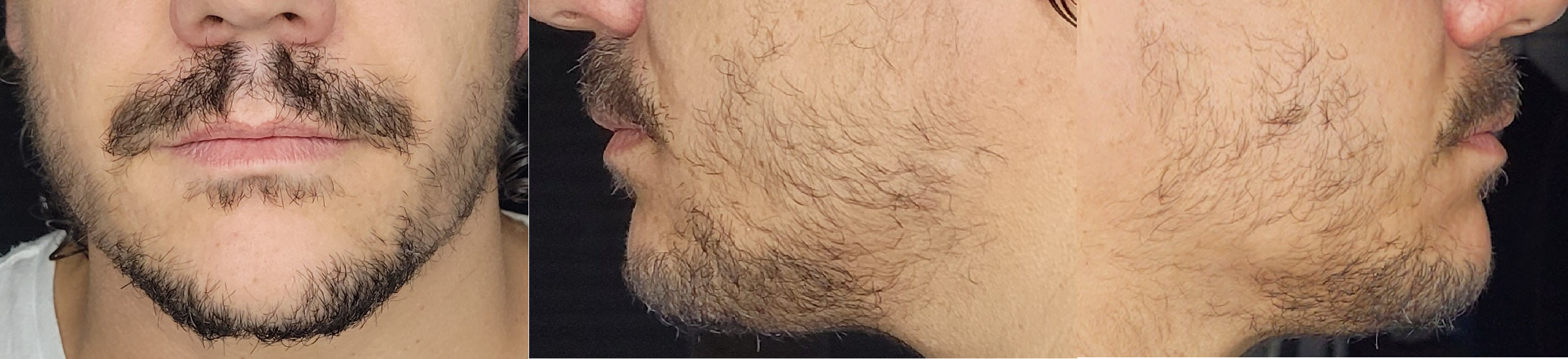 blog/growing-a-beard/2021-07-18.jpg