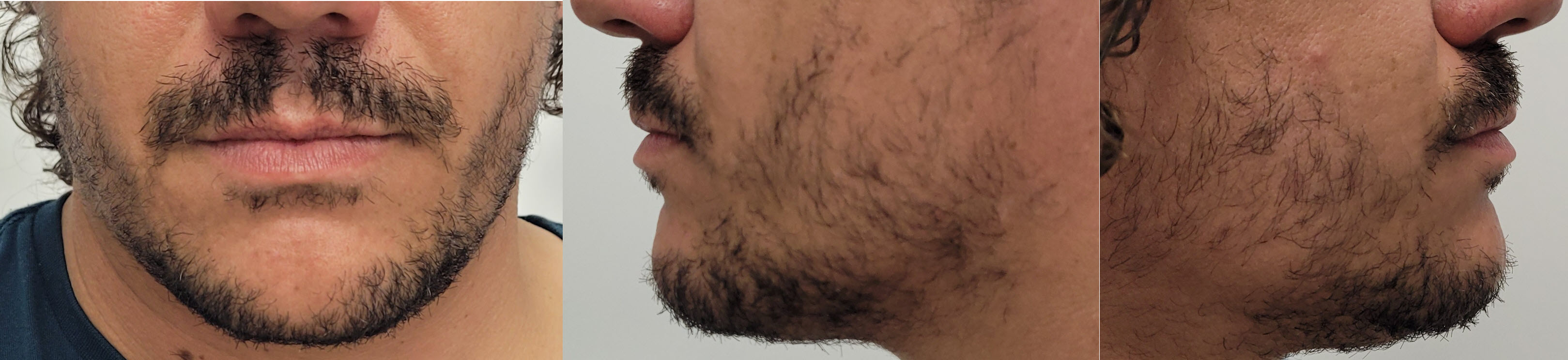 blog/growing-a-beard/2021-12-20.jpg