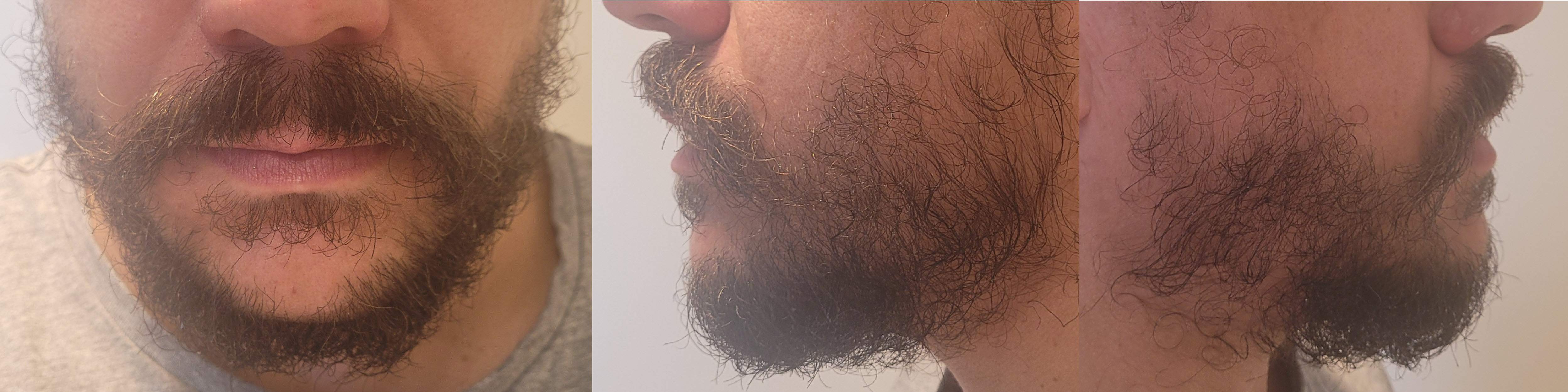 blog/growing-a-beard/2022-08-08.jpg