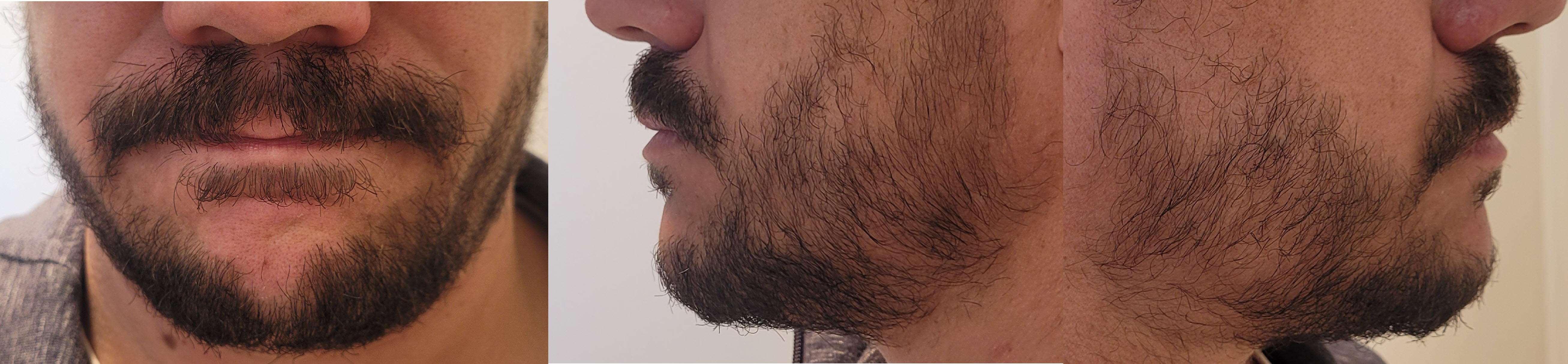 blog/growing-a-beard/2022-09-30.jpg