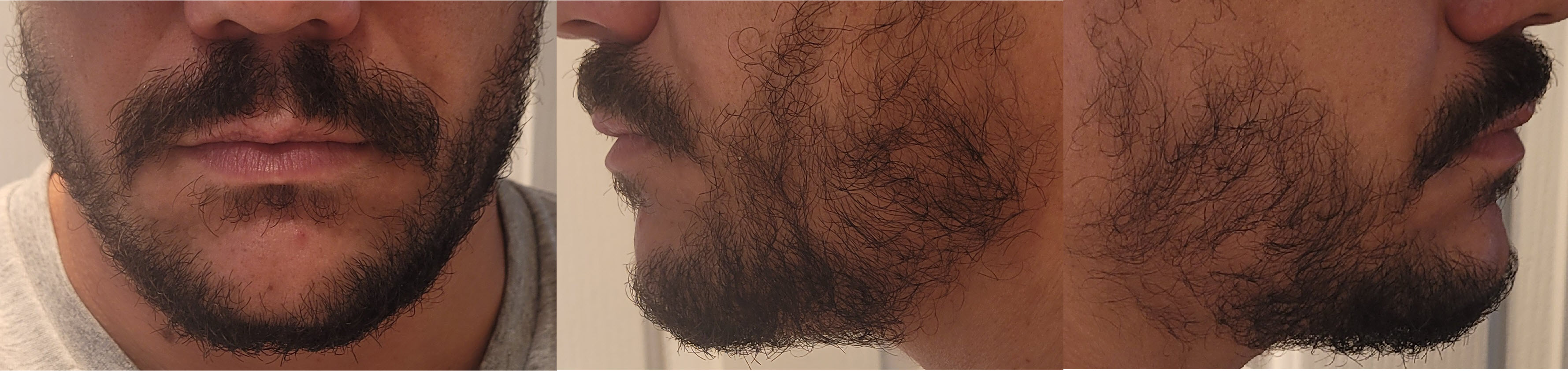 blog/growing-a-beard/2022-12-20.jpg