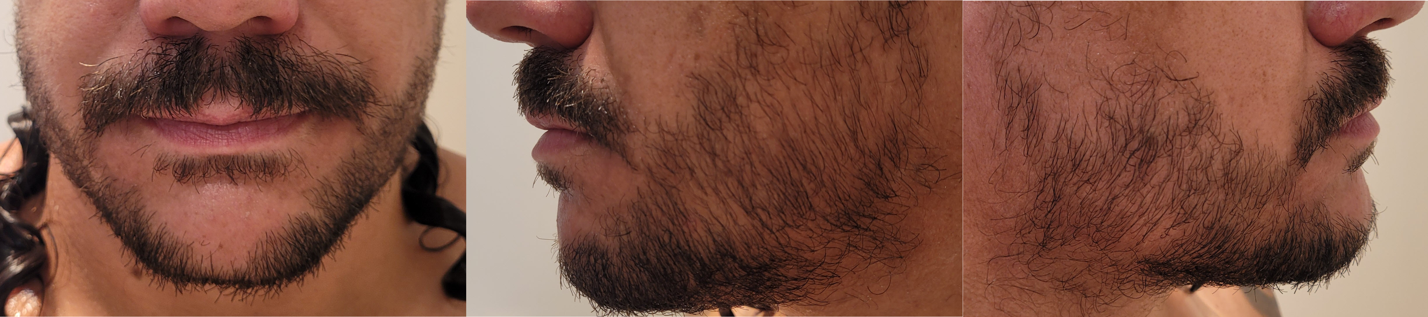 blog/growing-a-beard/2023-01-17.jpg