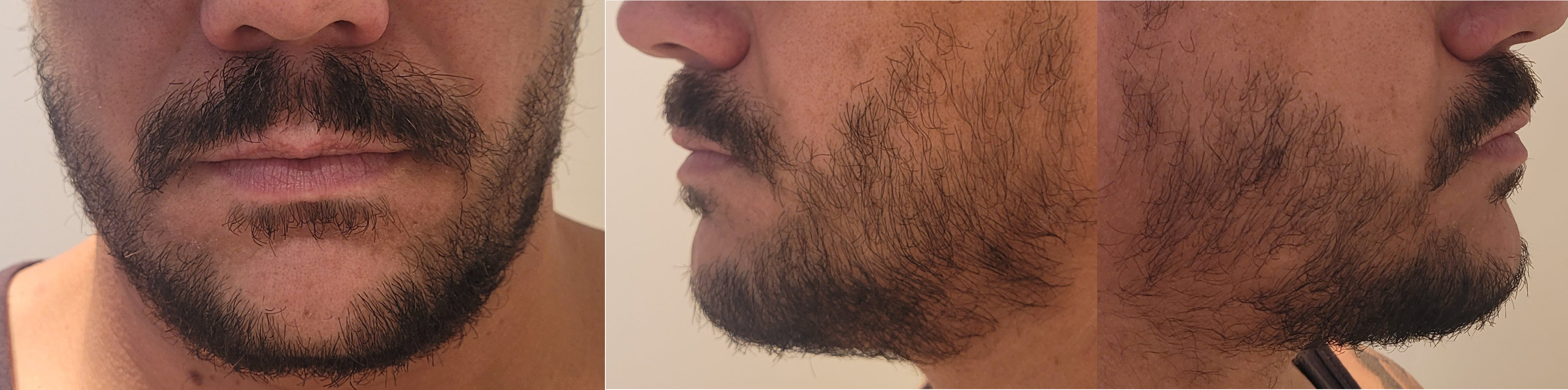 blog/growing-a-beard/2023-02-17.jpg