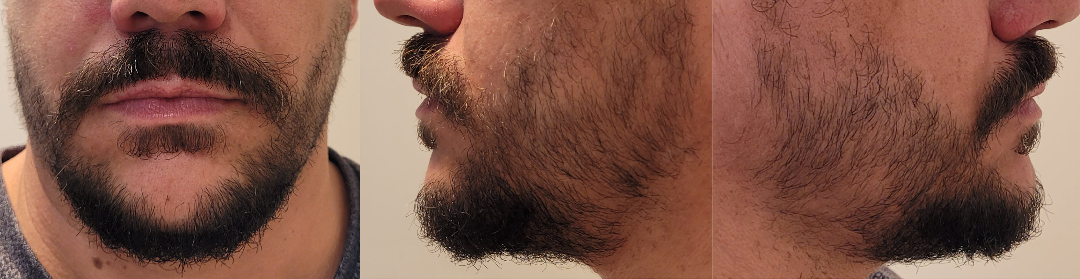 blog/growing-a-beard/2023-03-16.jpg