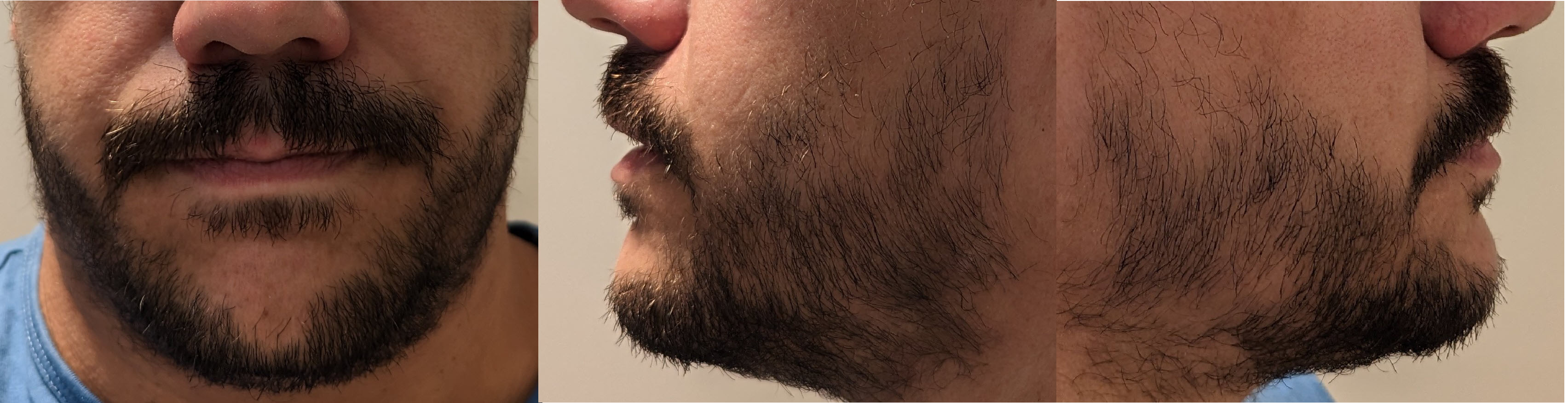 blog/growing-a-beard/2023-04-15.jpg