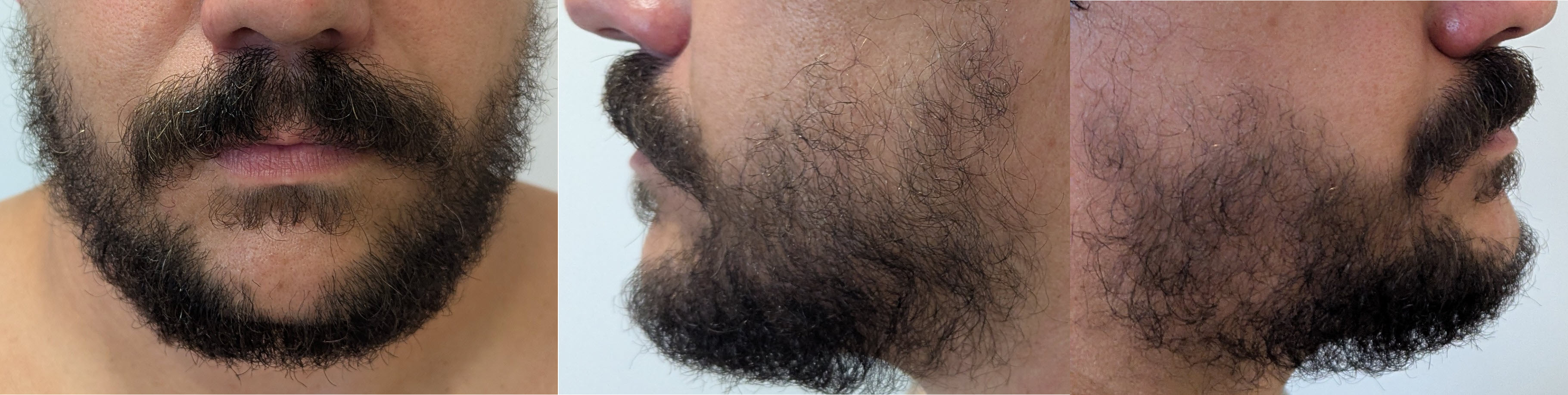 blog/growing-a-beard/2025-01-01.jpg